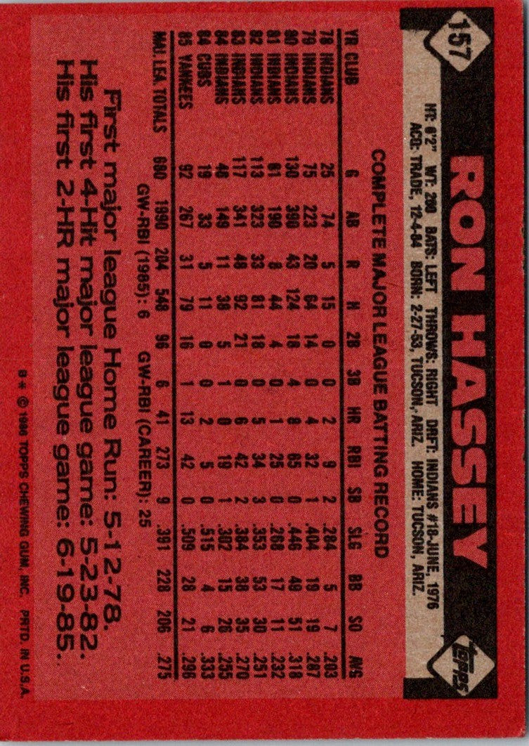 1986 Topps Ron Hassey