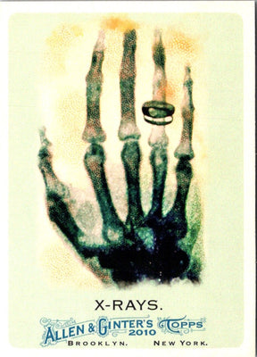 2010 Topps Allen & Ginter X-Rays #185
