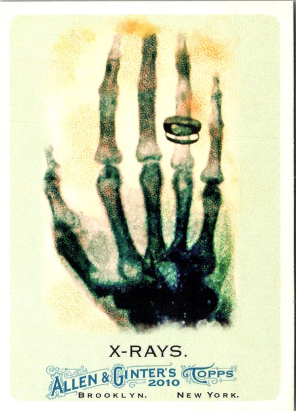 2010 Topps Allen & Ginter X-Rays #185